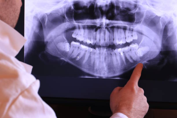 Emergency Dentist for Kids in VA