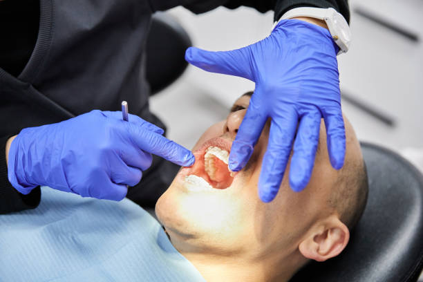 Best Dentist for Severe Toothache  in George Mason, VA