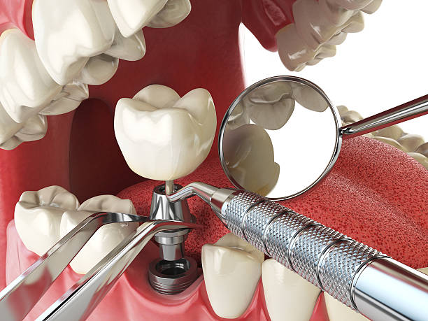 Best Emergency Dentist Near Me  in George Mason, VA